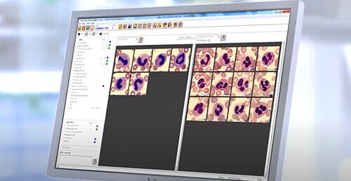 Peripheral Blood Application CellaVision<sup>®</sup>